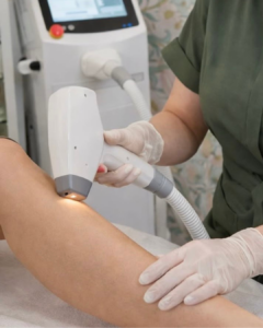 Permanent hair removal, laser